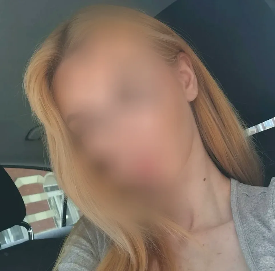 Fiona, 20